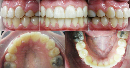 Free Virtual Consultation Greenberg Dental Orthodontics